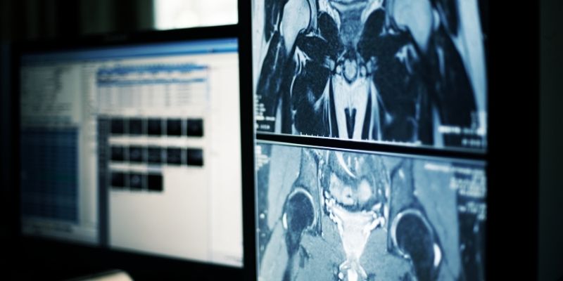 ai in healthcare