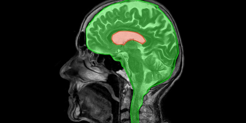 image segmentation